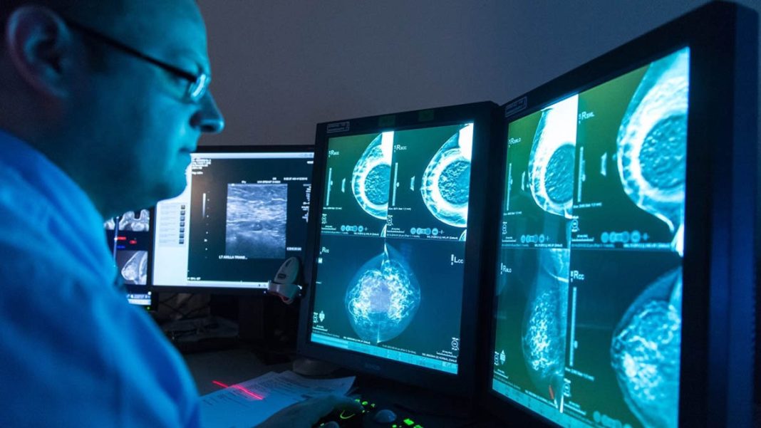 AI Outperforms Radiologists in Tests—Yet Demand for Certified Specialists Hits Record High